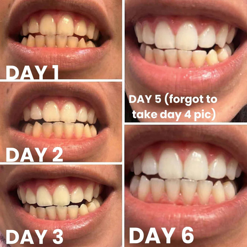 Osmo Teeth Whitening Strips